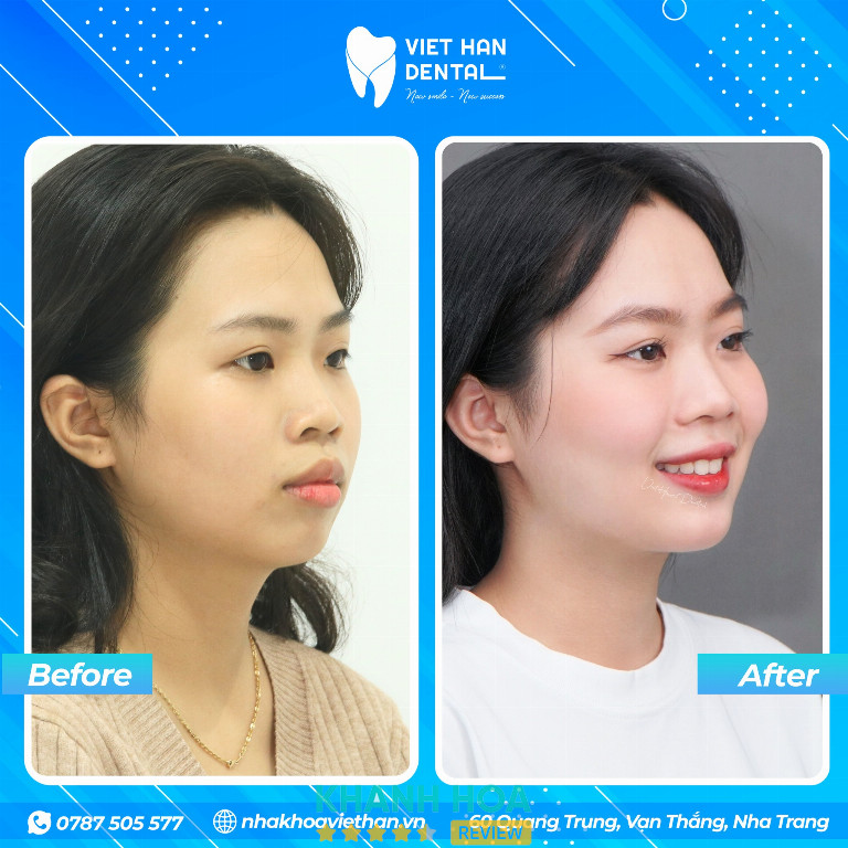 Nha khoa Việt Hàn - 60 Quang Trung