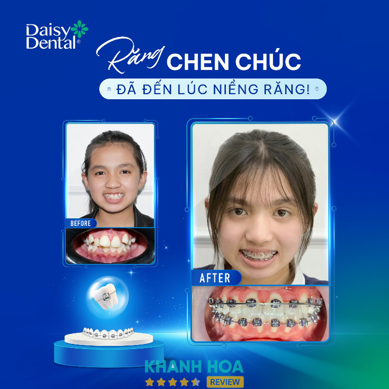 Nha khoa Quốc tế DAISY - 83 Yersin