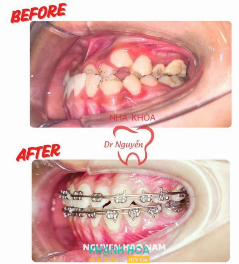 Nha khoa Dr Nguyễn - 17 Thái Nguyên