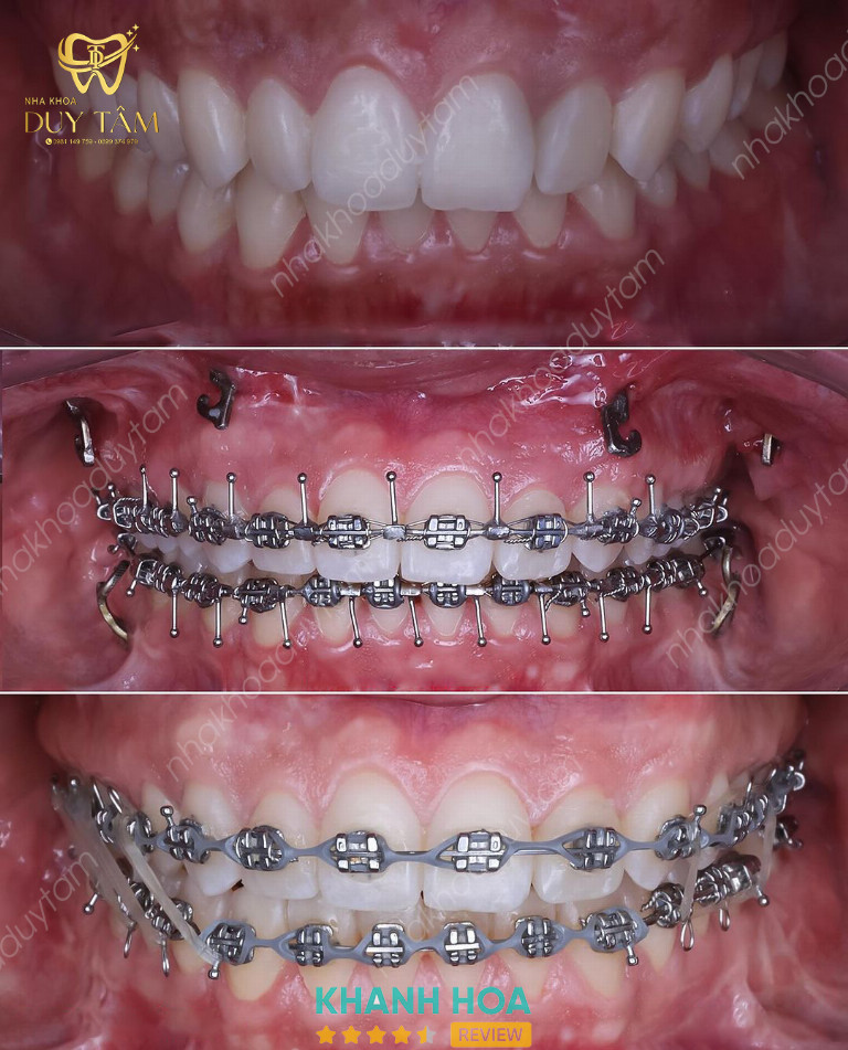 Nha khoa Duy Tâm - 140 Thống Nhất