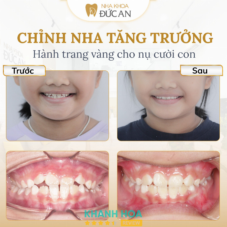 Nha Khoa Đức An - 208 Thống Nhất