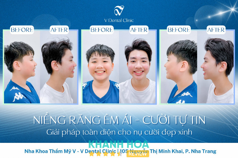Nha Khoa Thẩm Mỹ V (V Dental Clinic) - 105 Nguyễn Thị Minh Khai