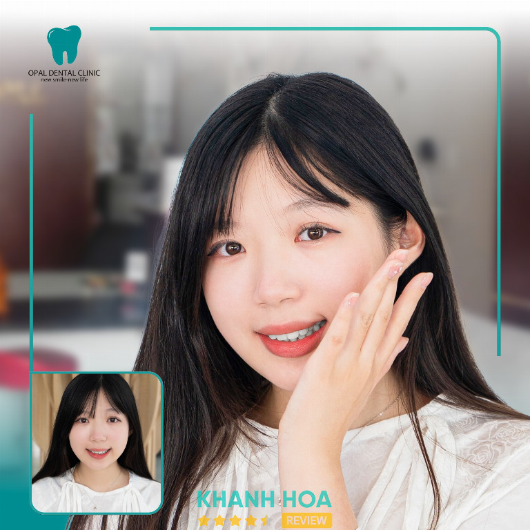 Opal Dental Clinic - 300 Lê Hồng Phong