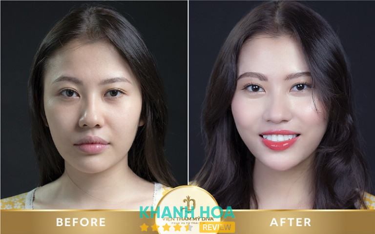 Viện Thẩm Mỹ Diva, Nha Trang