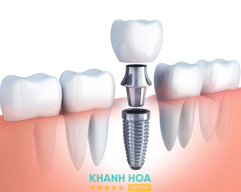 Nha Khoa Dr.Tooth, Nha Trang