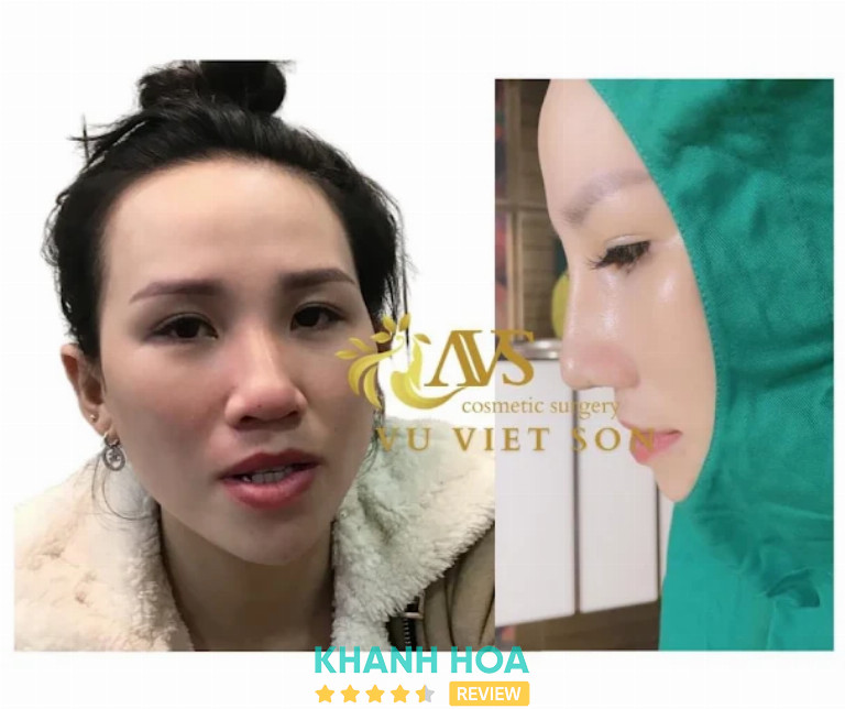 Viện Thẩm Mỹ Vũ Viết Sơn, Nha Trang