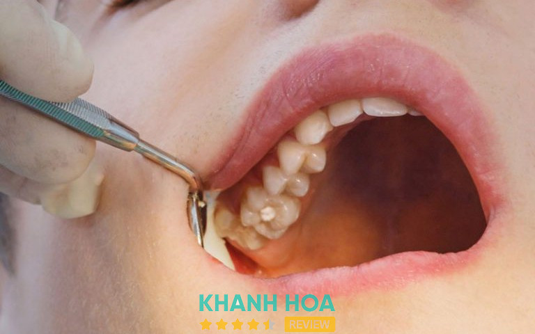 Nha Khoa Hoàn Mỹ, Nha Trang