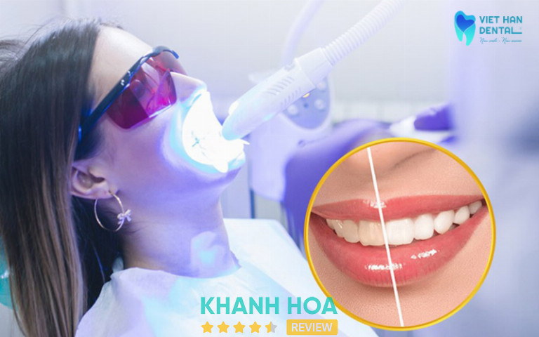 Nha Khoa Việt Hàn, Nha Trang