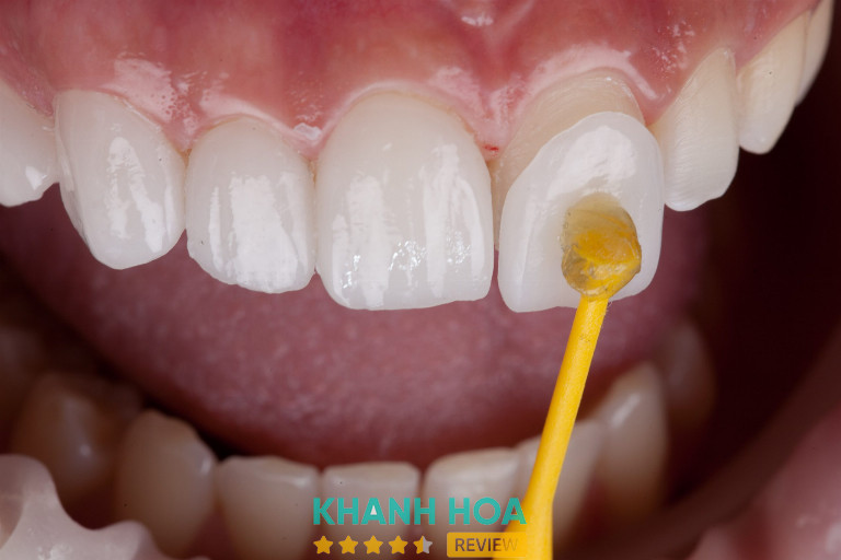 Sử dụng vật liệu sứ chính hãng, rõ nguồn gốc