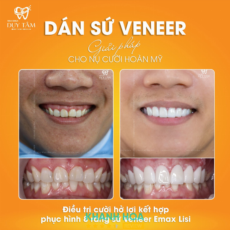 Nha khoa Duy Tâm - 140 Thống Nhất
