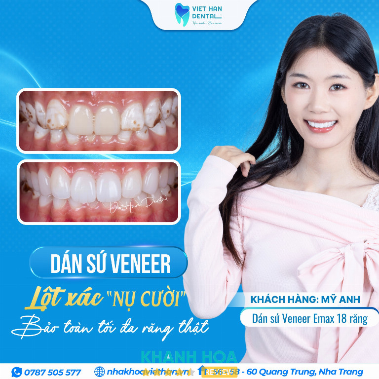 Nha Khoa Việt Hàn - 60 Quang Trung