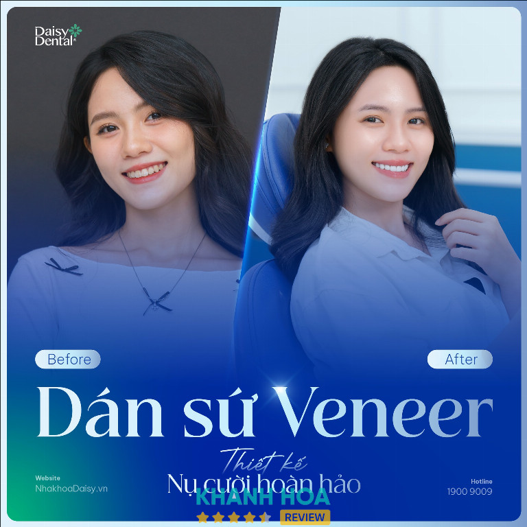 Nha khoa Quốc tế DAISY - 83 Yersin