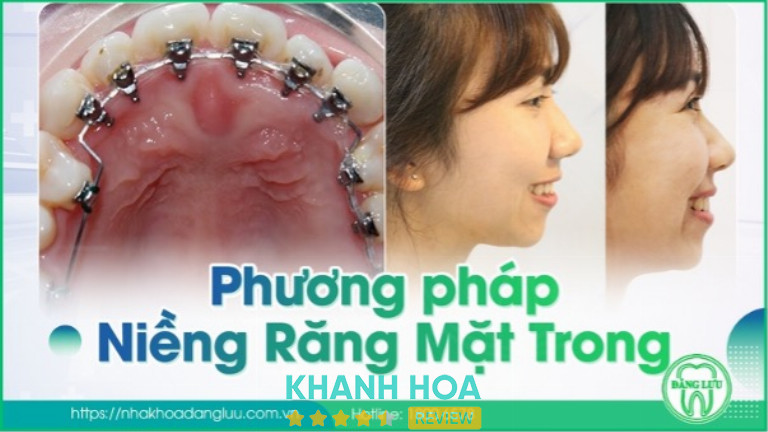 Nha khoa đăng lưu