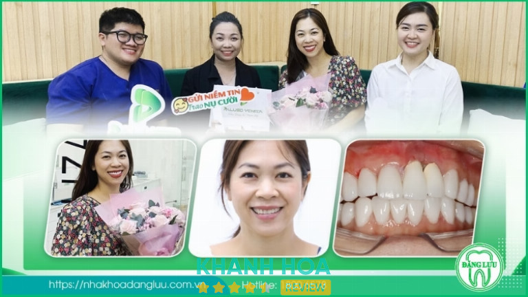 dịch vụ bọc răng sứ thẩm mỹ tại Nha Khoa Đăng Lưu