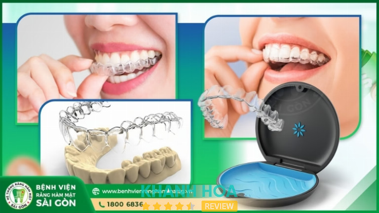 các phương pháp niềng răng tại Bệnh Viện Răng Hàm Mặt Sài Gòn