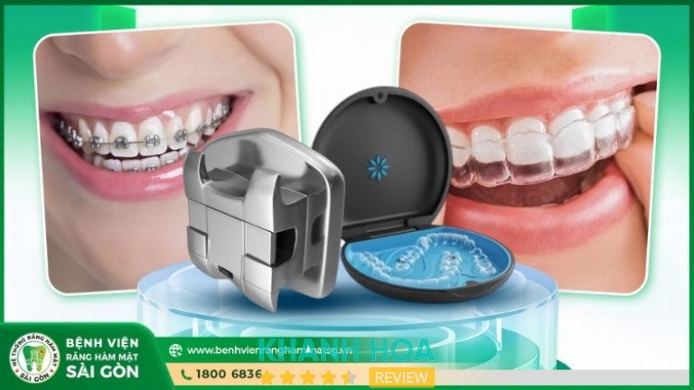 Dịch vụ niềng răng tại Bệnh Viện Răng Hàm Mặt Sài Gòn