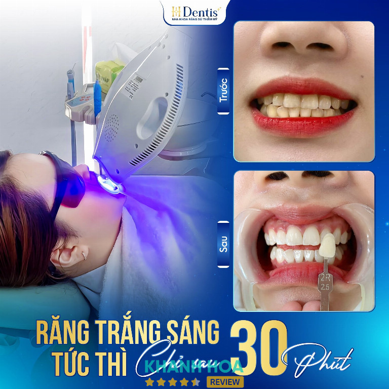 Nha Khoa Răng Sứ Thẩm Mỹ - H Dentis Diên Khánh